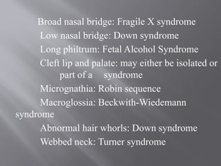 Broad nasal bridge: Fragile X syndrome
Low nasal bridge: Down syndrome
Long philtrum: Fetal Alcohol Syndrome
Cleft lip and palate: may either be isolated or
part of a syndrome
Micrognathia: Robin sequence
Macroglossia: Beckwith-Wiedemann
syndrome
Abnormal hair whorls: Down syndrome
Webbed neck: Turner syndrome
 