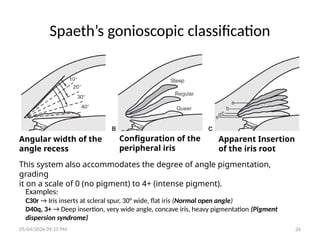 Comprehensive Approach to Diagnosing and Managing Glaucoma | PPTX