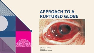 Globe Rupture Memory Note How to Approach a ruptured globe medically.pptx