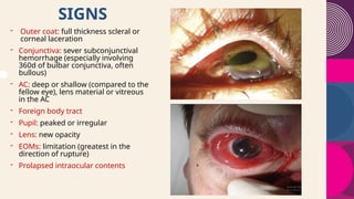 How to Approach a ruptured globe medically.pptx