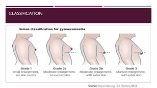 CLASSIFICATION
Source: https://doi.org/10.1136/bmj.i4833
 