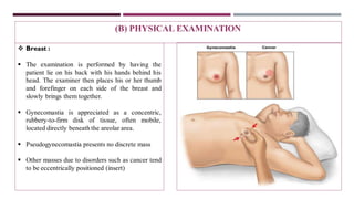 ❖ Breast :
▪ The examination is performed by having the
patient lie on his back with his hands behind his
head. The examiner then places his or her thumb
and forefinger on each side of the breast and
slowly brings them together.
▪ Gynecomastia is appreciated as a concentric,
rubbery-to-firm disk of tissue, often mobile,
located directly beneath the areolar area.
▪ Pseudogynecomastia presents no discrete mass
▪ Other masses due to disorders such as cancer tend
to be eccentrically positioned (insert)
(B) PHYSICAL EXAMINATION
 
