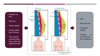 • Rubbery-to-
firm,
• Discrete ,
• Finely Lobular,
• Freely mobile
disc of tissue,
• That extend
concentrically
from under the
nipple & areola.
• Soft
• Non-discrete
• Irregularly
lobular
• Similarly to
subcutaneous
fat in abdomen
 