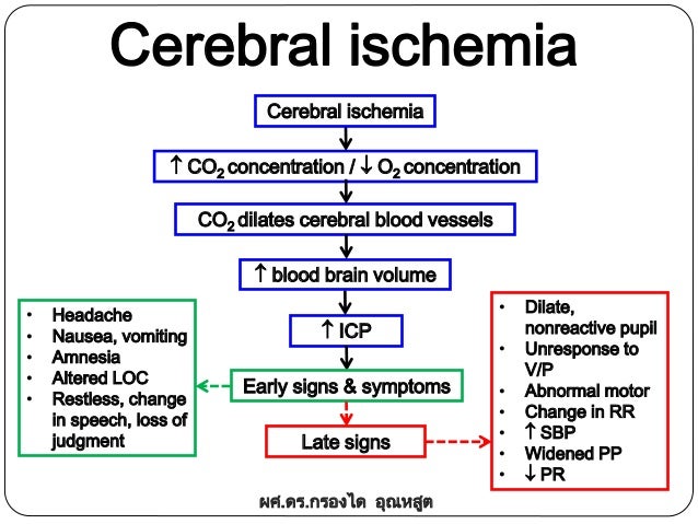 Intracranial Hypotension - Pseudotumor Cerebri Demo I Intracranial Hypotension - Pseudotumor Cerebri Demo I