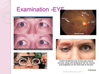 Examination -EYE
Sandhya Manorenj 11/2/17
 