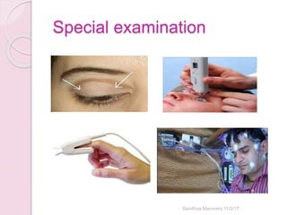 Special examination
Sandhya Manorenj 11/2/17
 