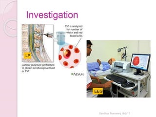 Investigation
Sandhya Manorenj 11/2/17
EEG
LP
 
