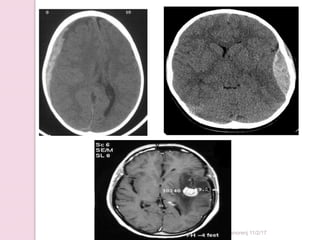 Sandhya Manorenj 11/2/17
 