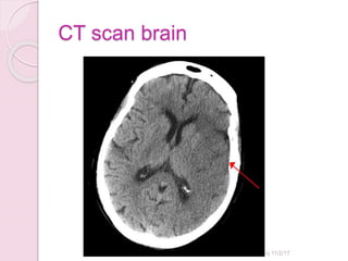 CT scan brain
Sandhya Manorenj 11/2/17
 