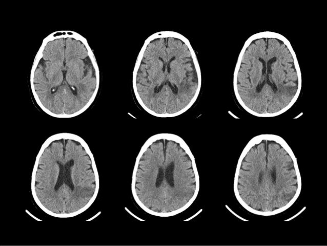Approach to head ct