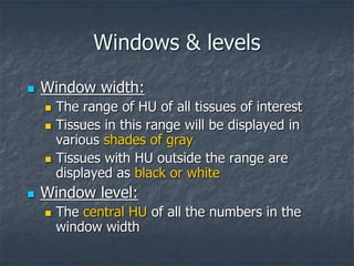 Windows & levels
 Window width:
 The range of HU of all tissues of interest
 Tissues in this range will be displayed in
various shades of gray
 Tissues with HU outside the range are
displayed as black or white
 Window level:
 The central HU of all the numbers in the
window width
 