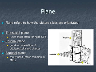 Plane
 Transaxial plane
 used most often for head CT’s
 Coronal plane
 good for evaluation of
pituitary/sella and sinuses
 Saggital plane
 rarely used (more common in
MRI)
 Plane refers to how the picture slices are orientated
 