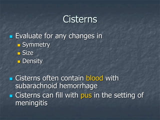 Cisterns
 Evaluate for any changes in
 Symmetry
 Size
 Density
 Cisterns often contain blood with
subarachnoid hemorrhage
 Cisterns can fill with pus in the setting of
meningitis
 