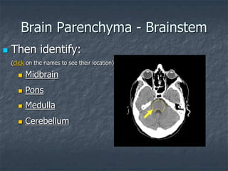 Brain Parenchyma - Brainstem
 Then identify:
(click on the names to see their location)
 Pons
 Cerebellum
 Midbrain
 Medulla
 