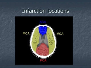 Infarction locations
 
