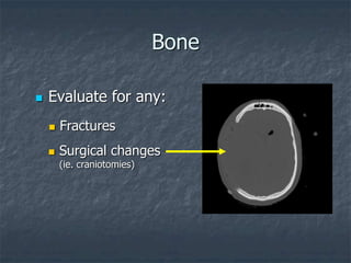 Bone
 Evaluate for any:
 Fractures
 Surgical changes
(ie. craniotomies)
 