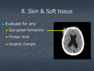 8. Skin & Soft tissue
 Evaluate for any:
 Surgical changes
 Sub-galeal hematoma
 Foreign body
 
