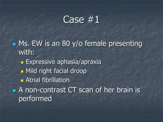 Case #1
 Ms. EW is an 80 y/o female presenting
with:
 Expressive aphasia/apraxia
 Mild right facial droop
 Atrial fibrillation
 A non-contrast CT scan of her brain is
performed
 