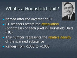 What’s a Hounsfield Unit?
 Named after the inventor of CT
 CT scanners record the attenuation
(brightness) of each pixel in Hounsfield Units
(HU)
 This number represents the relative density
of the scanned substance
 Ranges from -1000 to +1000
 