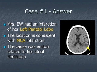 Case #1 - Answer
 Mrs. EW had an infarction
of her Left Parietal Lobe
 The location is consistent
with MCA infarction
 The cause was emboli
related to her atrial
fibrillation
 