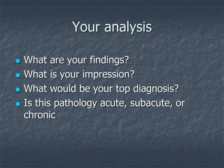 Your analysis
 What are your findings?
 What is your impression?
 What would be your top diagnosis?
 Is this pathology acute, subacute, or
chronic
 