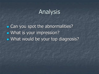 Analysis
 Can you spot the abnormalities?
 What is your impression?
 What would be your top diagnosis?
 