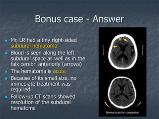 Bonus case - Answer
 Mr. LR had a tiny right-sided
subdural hematoma
 Blood is seen along the left
subdural space as well as in the
falx cerebri anteriorly (arrows)
 The hematoma is acute
 Because of its small size, no
immediate treatment was
required
 Follow-up CT scans showed
resolution of the subdural
hematoma
Normal scan for comparison
 