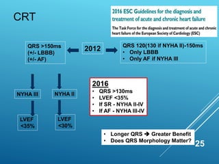 CRT
25
QRS >150ms
(+/- LBBB)
(+/- AF)
NYHA III
LVEF
<35%
QRS 120(130 if NYHA II)-150ms
• Only LBBB
• Only AF if NYHA III
NYHA II
LVEF
<30%
2016
• QRS >130ms
• LVEF <35%
• If SR - NYHA II-IV
• If AF - NYHA III-IV
• Longer QRS  Greater Benefit
• Does QRS Morphology Matter?
2012
 