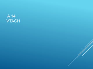 A 14
VTACH
 