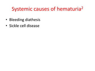 Systemic causes of hematuria2
• Bleeding diathesis
• Sickle cell disease
 