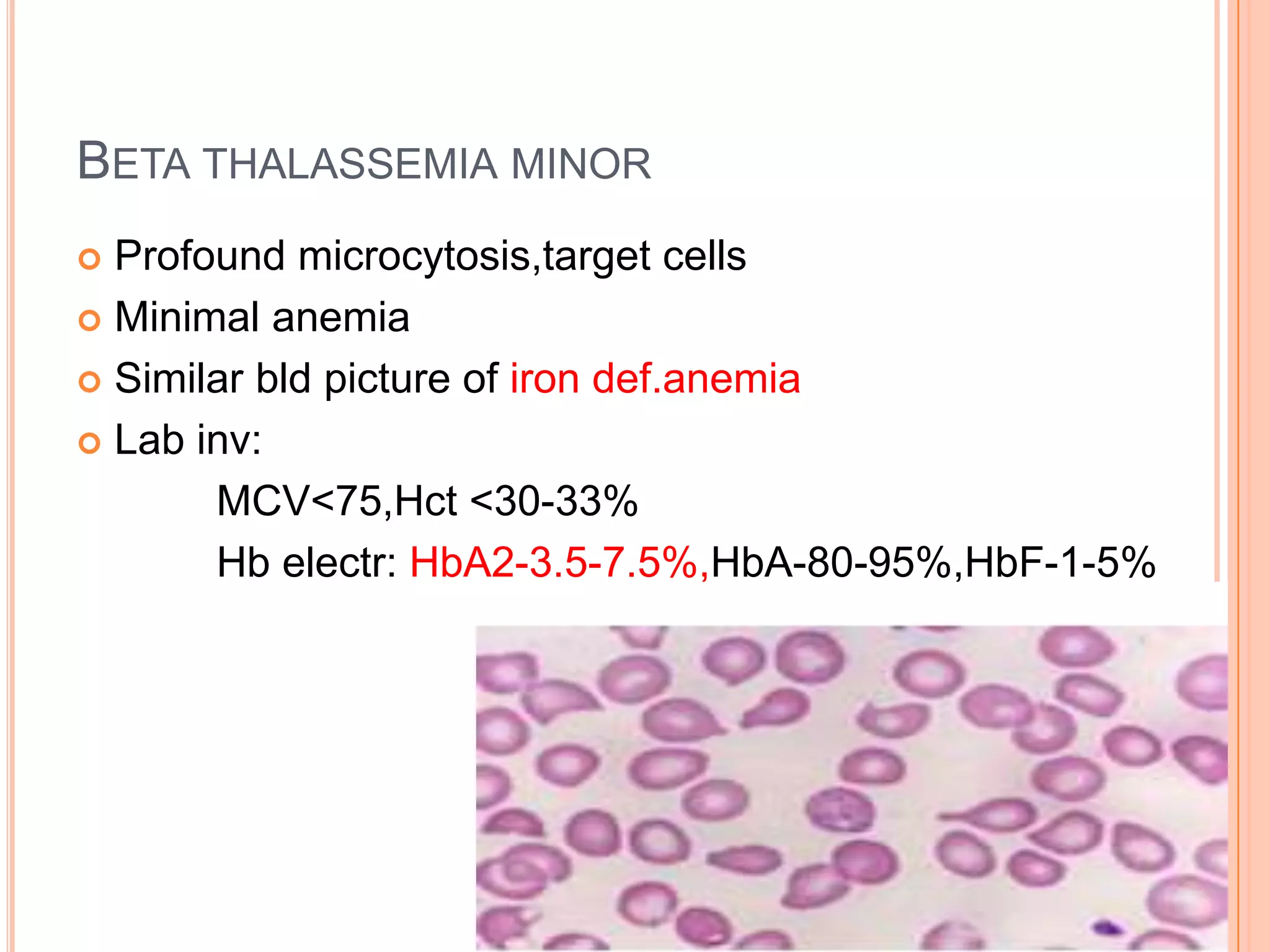 BETA THALASSEMIA MINOR
 Profound microcytosis,target cells
 Minimal anemia
 Similar bld picture of iron def.anemia
 Lab inv:
MCV<75,Hct <30-33%
Hb electr: HbA2-3.5-7.5%,HbA-80-95%,HbF-1-5%
 