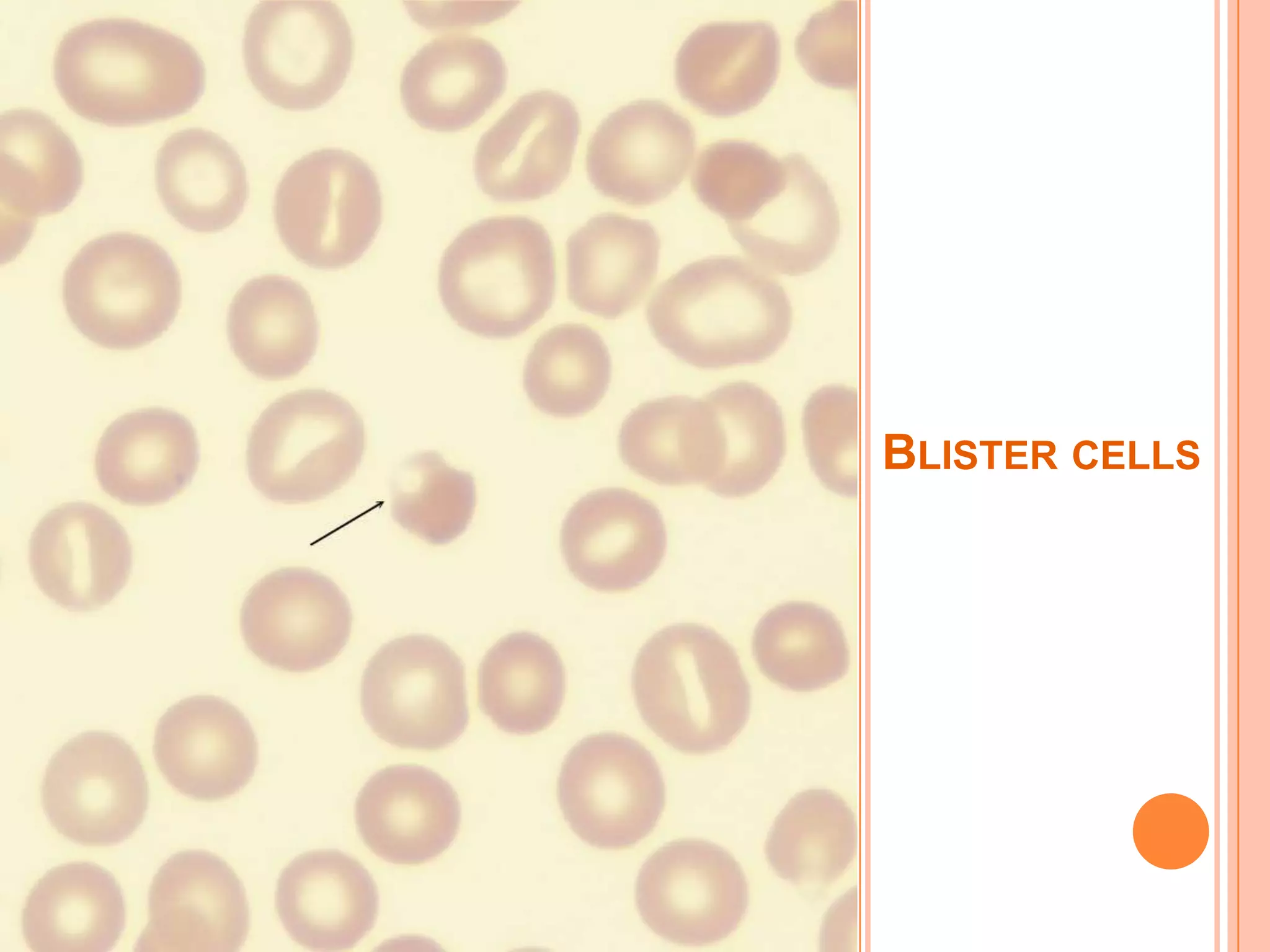 BLISTER CELLS
 