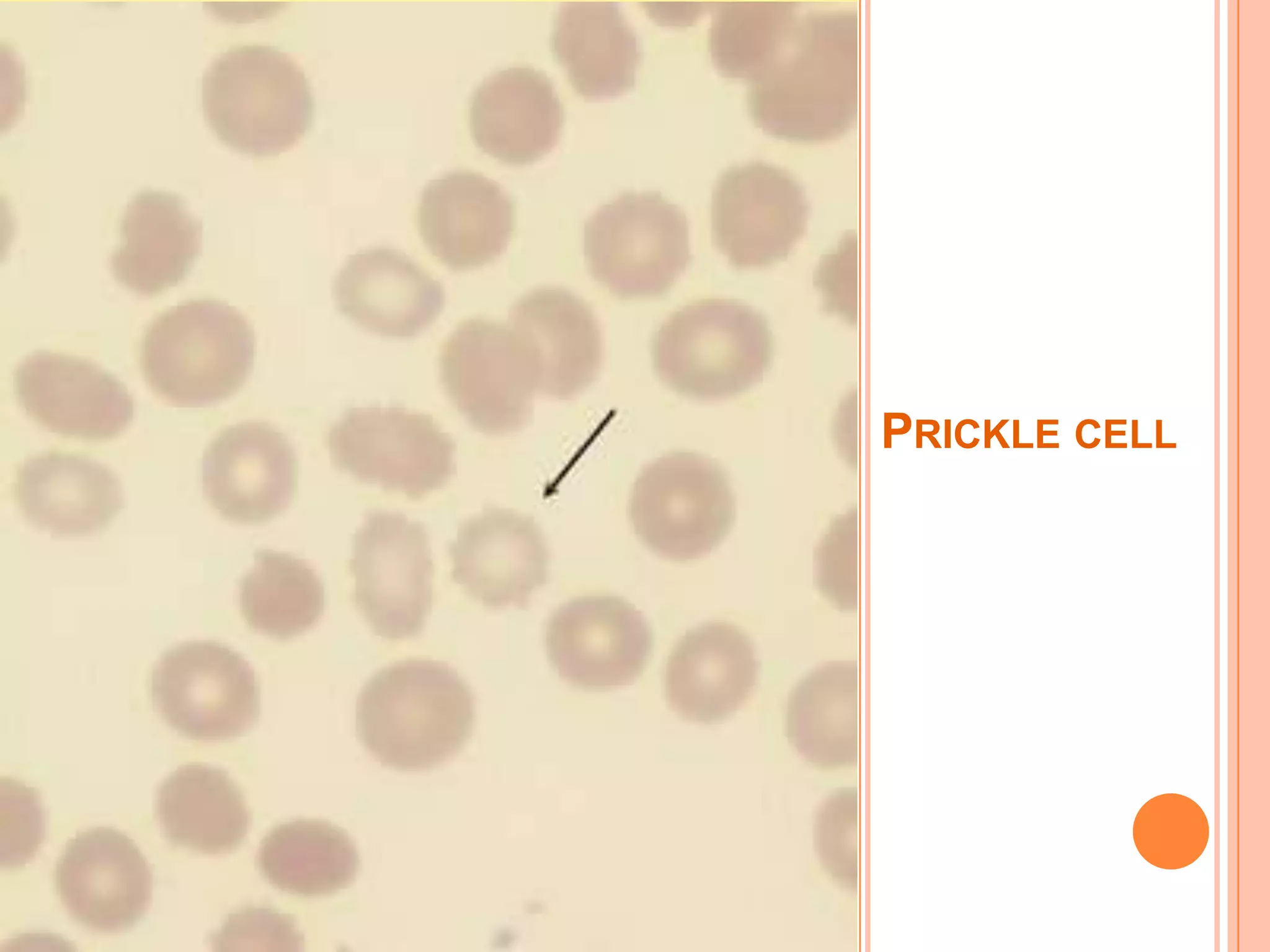 PRICKLE CELL
 