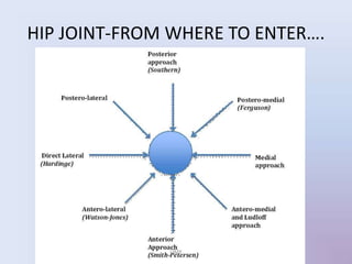 HIP JOINT-FROM WHERE TO ENTER….
UMY
 