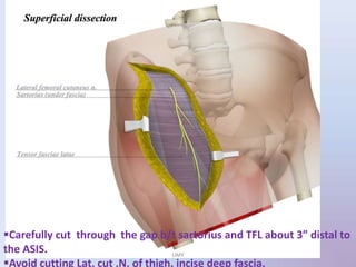 Carefully cut through the gap b/t sartorius and TFL about 3” distal to
the ASIS.
Avoid cutting Lat. cut .N. of thigh, incise deep fascia.
UMY
 