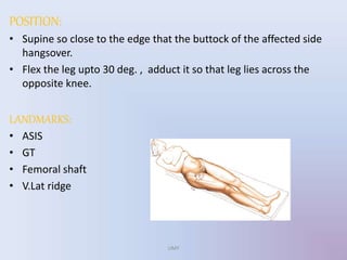POSITION:
• Supine so close to the edge that the buttock of the affected side
hangsover.
• Flex the leg upto 30 deg. , adduct it so that leg lies across the
opposite knee.
LANDMARKS:
• ASIS
• GT
• Femoral shaft
• V.Lat ridge
UMY
 