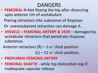 • FEMORAL N-Not flexing the hip after dissecting
upto anterior rim of acetabulum
Placing retractors into substance of iliopsoas
Or overexuberant retraction can damage it..
• VESSELS – FEMORAL ARTERY & VEIN – damaged by
acetabular retractors that penetrate iliopsoas
substance.
Anterior retractors (R) – 1-o` clock position
(L) – 11-o` clock position.
• PROFUNDA FEMORIS ARTERY
• FEMORAL SHAFT# - while hip dislocation esp if
inadequate capsular release
DANGERS
UMY
 