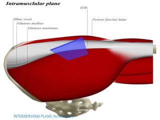 INTERNERVOUS PLANE: No true plane UMY
 
