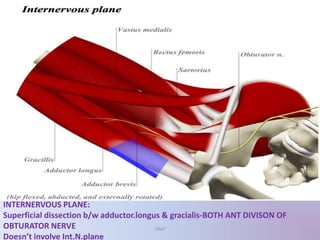 INTERNERVOUS PLANE:
Superficial dissection b/w adductor.longus & gracialis-BOTH ANT DIVISON OF
OBTURATOR NERVE
Doesn’t involve Int.N.plane
UMY
 