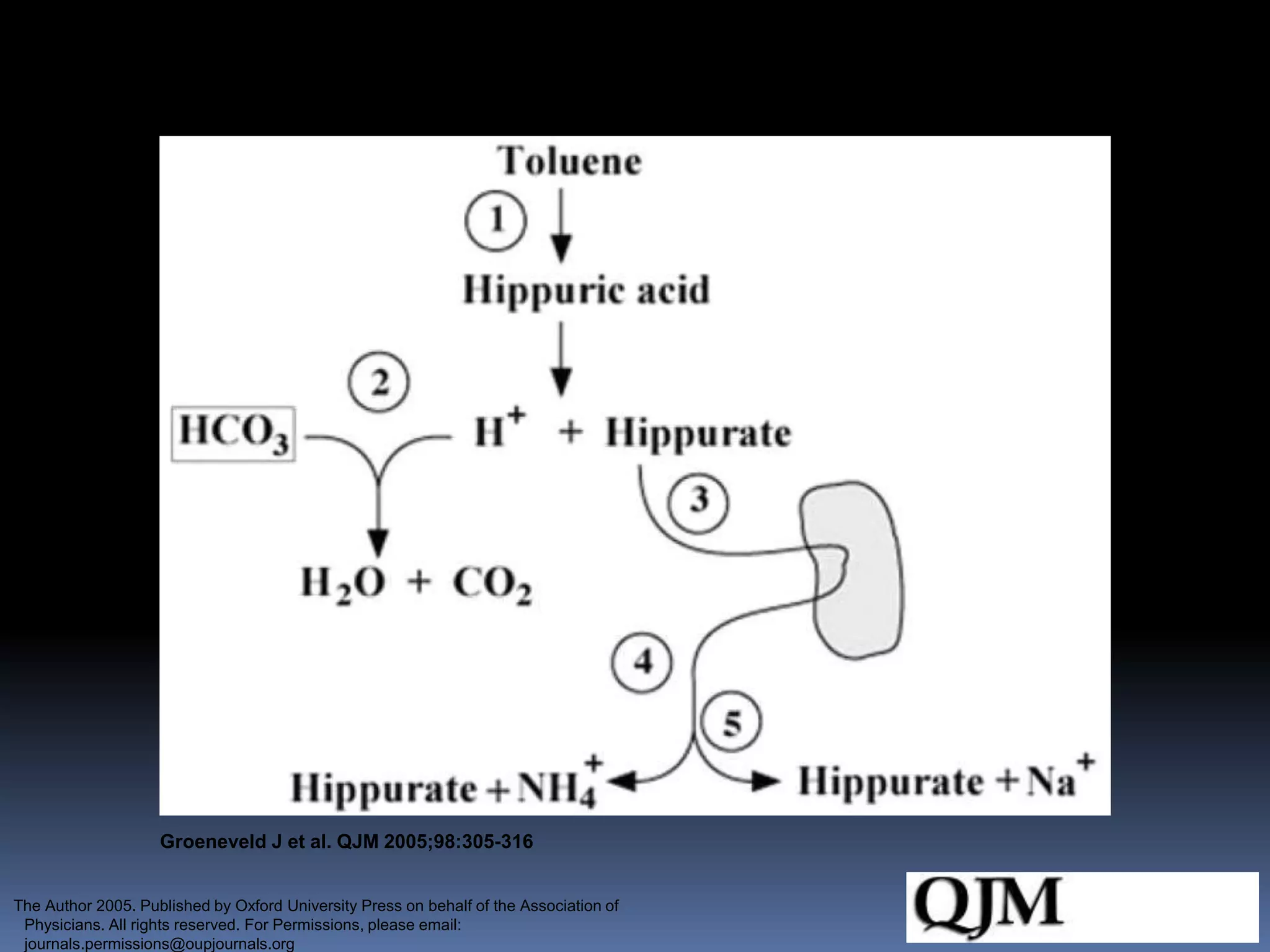 Indirect loss of NaHCO3 in glue sniffing.
Groeneveld J et al. QJM 2005;98:305-316
The Author 2005. Published by Oxford University Press on behalf of the Association of
Physicians. All rights reserved. For Permissions, please email:
journals.permissions@oupjournals.org
 