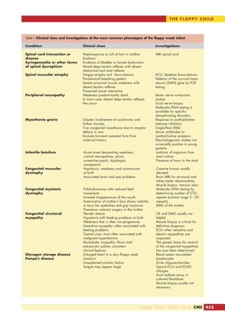 Table I. Clincical clues and investigations of the more common phenotypes of the floppy weak infant
Condition Clinical clues Investigations
Spinal cord transection or Haemangioma or tuft of hair in midline MRI spinal cord
disease Scoliosis
Syringomyelia or other forms Evidence of bladder or bowel dysfunction
of spinal dysraphism Mixed deep tendon reflexes with absent
abdominal and anal reflexes
Spinal muscular atrophy Tongue atrophy and fasciculations ECG: Baseline fasciculations
Paradoxical breathing pattern Deletion of the survival motor
Severe proximal muscle weakness with neuron (SMN) gene by PCR
absent tendon reflexes testing
Preserved social interaction
Peripheral neuropathy Weakness predominantly distal Motor nerve conduction
In most cases absent deep tendon reflexes studies
Pes cavus Sural nerve biopsy
Molecular DNA testing is
available for specific
demyelinating disorders
Myasthenia gravis Greater involvement of oculomotor and Response to acethylcholine
bulbar muscles esterase inhibitors
True congenital myasthenia due to receptor Single-fibre EMG
defects is rare Serum antibodies to
Exclude transient neonatal form from acethylcholine receptors
maternal history Electrodiagnostic studies not
universally positive in young
patients
Infantile botulism Acute onset descending weakness, Isolation of organism from
cranial neuropathies, ptosis, stool culture
unreactive pupils, dysphagia, Presence of toxin in the stool
constipation
Congenital muscular Hypotonia, weakness and contractures Creatine kinase usually
dystrophy at birth elevated
Associated brain and eye problems Brain MRI for structural and
white matter abnormalities
Muscle biopsy: merosin stain
Congenital myotonic Polyhydramnios with reduced fetal Molecular DNA testing by
dystrophy movements determining number of CTG
Inverted V-appearance of the mouth repeats (normal range 5 - 39
Examination of mother’s face shows inability repeats)
to bury her eyelashes and grip myotonia EMG of the mother
Premature cataract surgery in the mother
Congenital structural Slender stature CK and EMG usually not
myopathy Hypotonia with feeding problems at birth helpful
Weakness that is often non-progressive Muscle biopsy is critical for
Nemaline myopathy: often associated with definitive diagnosis.
feeding problems ECG when nemaline and
Central core: most often associated with desmin myopathies are
malignant hyperthermia suspected
Myotubular myopathy: Ptosis and The genetic basis for several
extraocular palsies consistent of the congenital myopathies
clinical features has now been determined
Glycogen storage disease Enlarged heart in a very floppy weak Blood smear vacuolated
Pompe’s disease newborn lymphocytes
Unexplained cardiac failure Urine oligosaccharides
Tongue may appear large Typical ECG and ECHO
changes
Acid maltase assay in
cultured fibroblasts
Muscle biopsy usually not
necessary
THE FLOPPY CHILD
August 2004 Vol.22 No.8 CME 453
 
