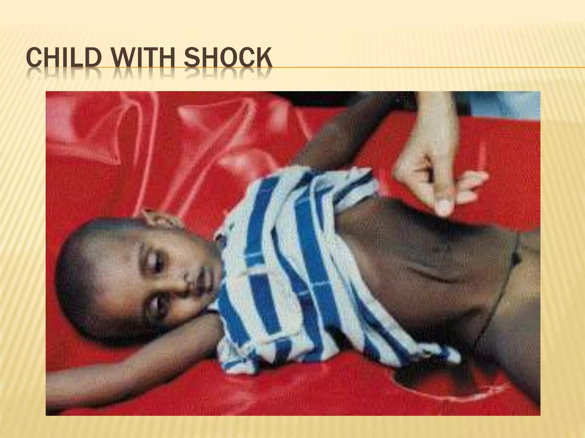 CHILD WITH SHOCK 
 