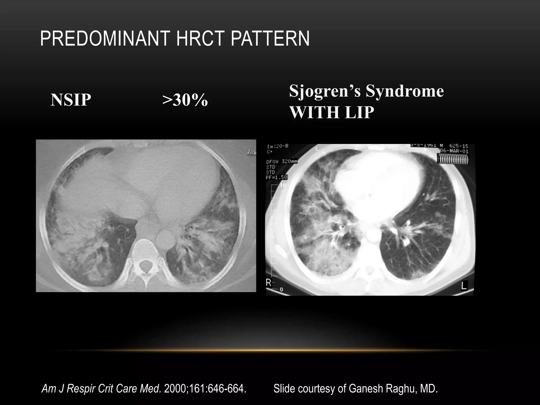 Approach to ild & update | PPTX