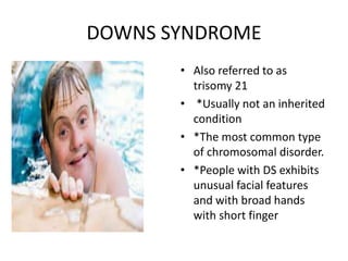 DOWNS SYNDROME
• Also referred to as
trisomy 21
• *Usually not an inherited
condition
• *The most common type
of chromosomal disorder.
• *People with DS exhibits
unusual facial features
and with broad hands
with short finger
 