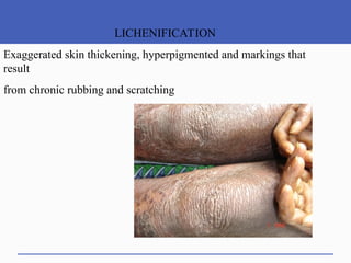 Exaggerated Skin Approach to intergumentery system.pptajhv,,iukfjhmaJZVHJJL,ylflx fhjvyU ...