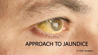 APPROACH TO JAUNDICE
Dr. Vivek. Goudgaon
 