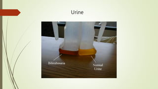Urine
 