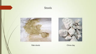 Stools
Pale stools China clay
 