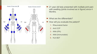 APPROACH TO JOINT PAIN AND ARTHRITIS.pptx