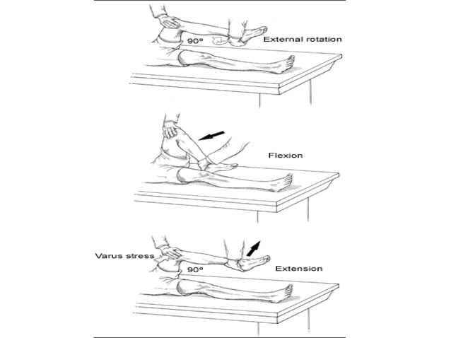 Approach to knee pain PPT